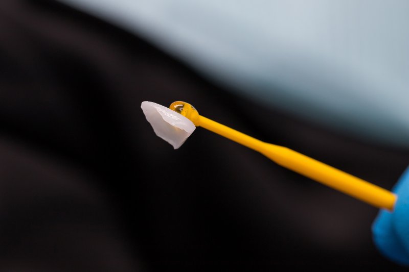 A closeup of a veneer placed on a dental tool