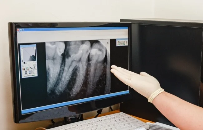 Digital X-Rays
