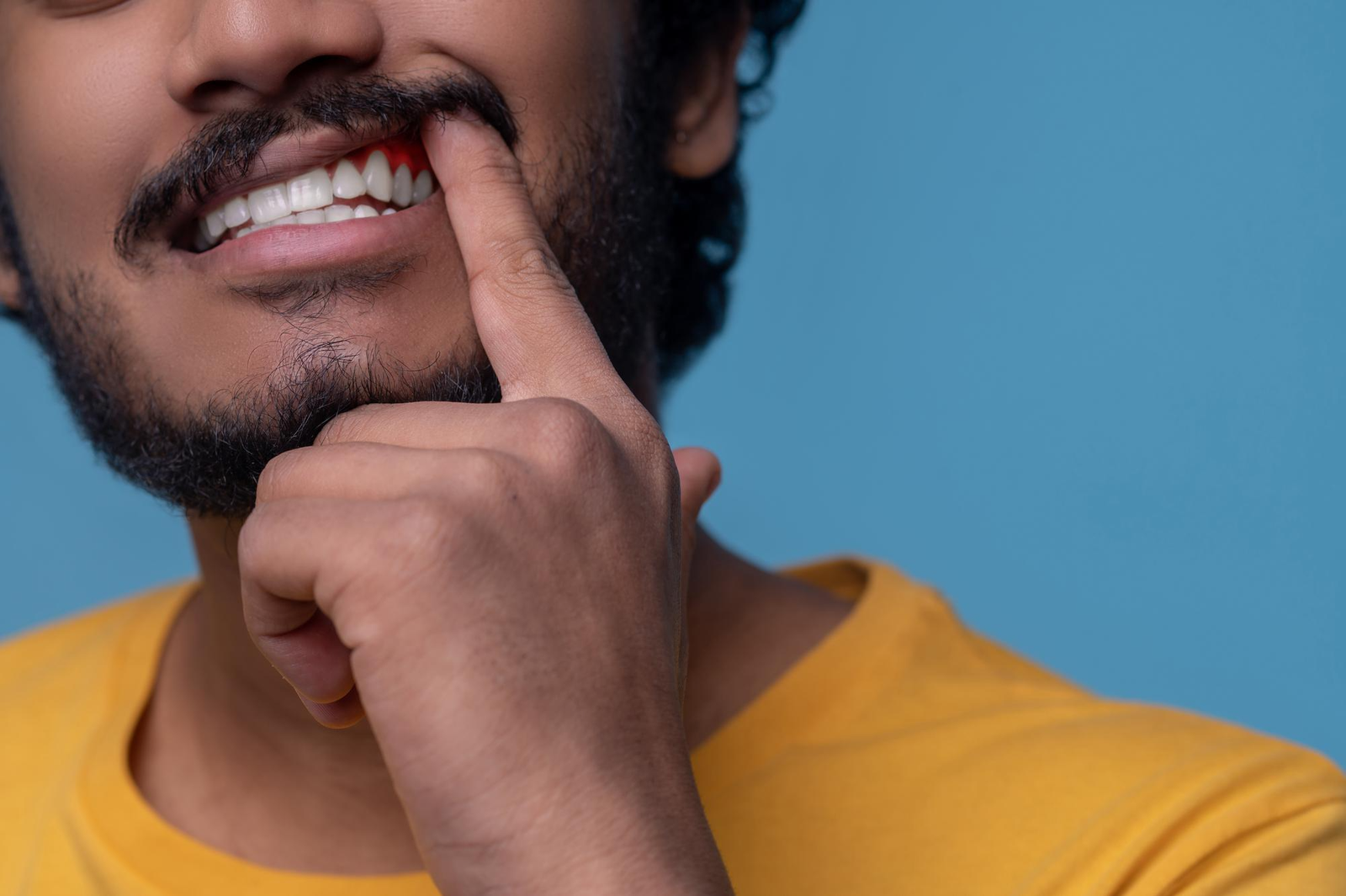 White Spots on Gums