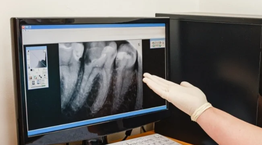 Digital X-Rays